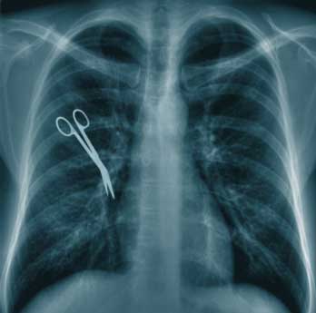 Medical Malpractice Lawsuit