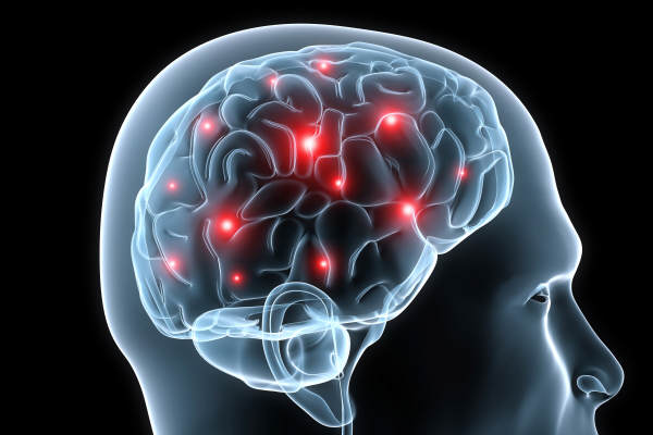car crash brain injury