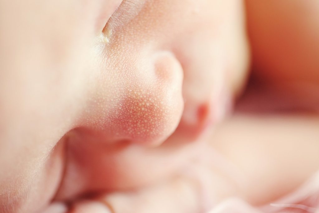 c-section birth injury
